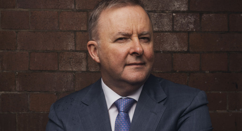 anthony albanese