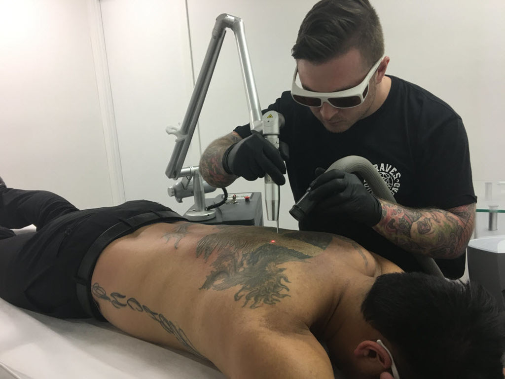 Tattoo removal businesses are making a mark as more people have regrets